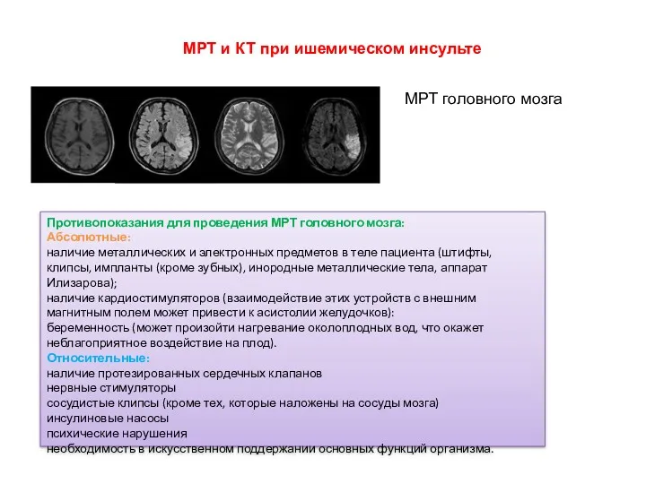 МРТ и КТ при ишемическом инсульте Противопоказания для проведения МРТ