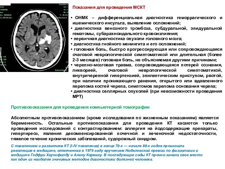 Противопоказания для проведения компьютерной томографии Абсолютным противопоказанием (кроме исследования по