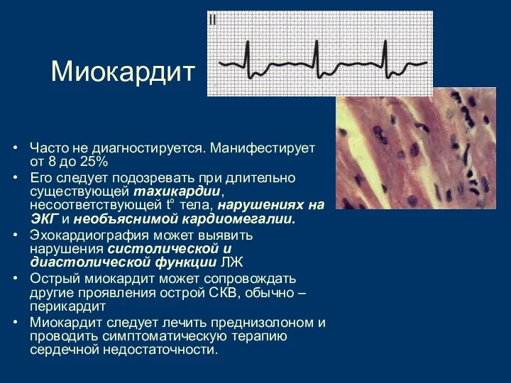 Миокардит Часто не диагностируется. Манифестирует от 8 до 25% Его