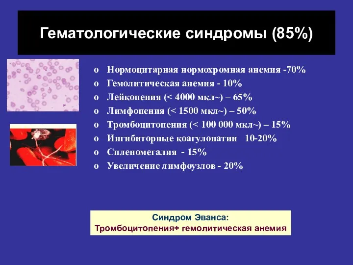 Гематологические синдромы (85%) Нормоцитарная нормохромная анемия -70% Гемолитическая анемия -