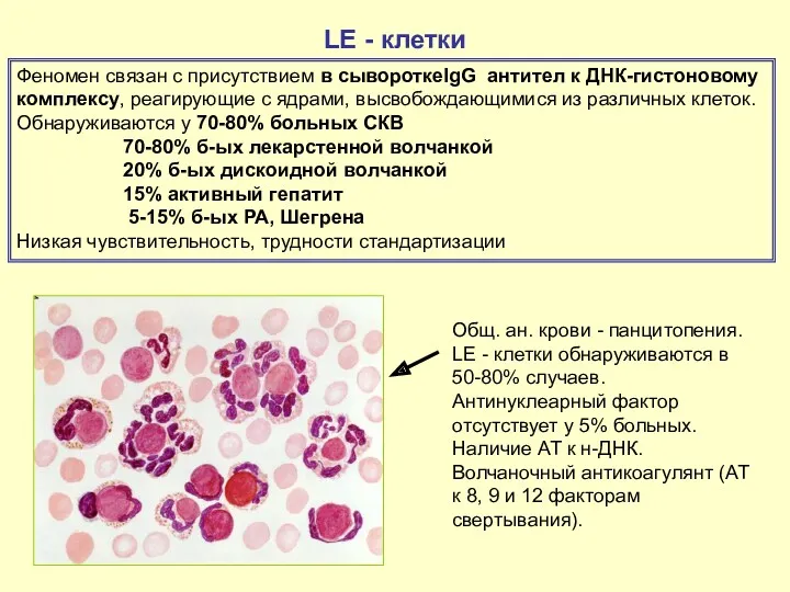 LE - клетки Феномен связан с присутствием в сывороткеIgG антител