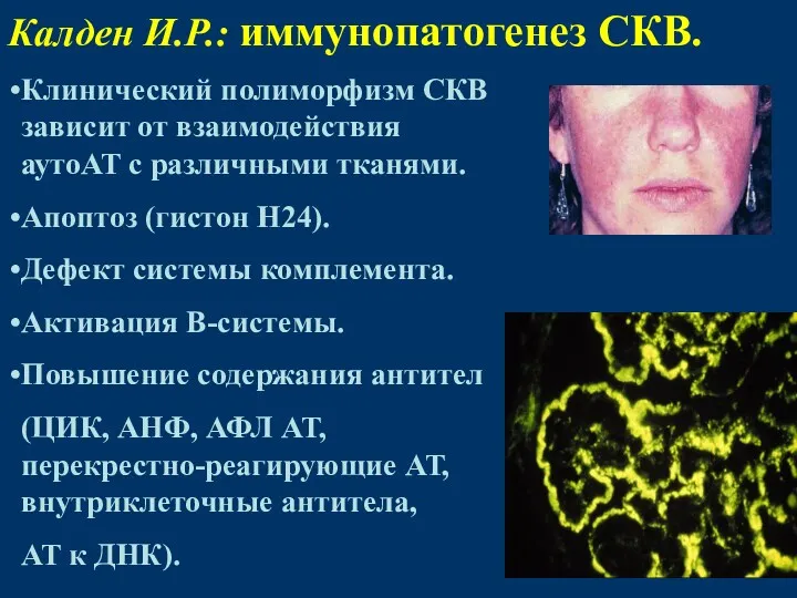 Калден И.Р.: иммунопатогенез СКВ. Клинический полиморфизм СКВ зависит от взаимодействия