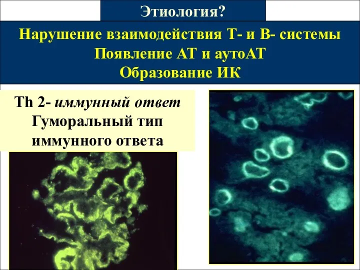 Нарушение взаимодействия Т- и В- системы Появление АТ и аутоАТ