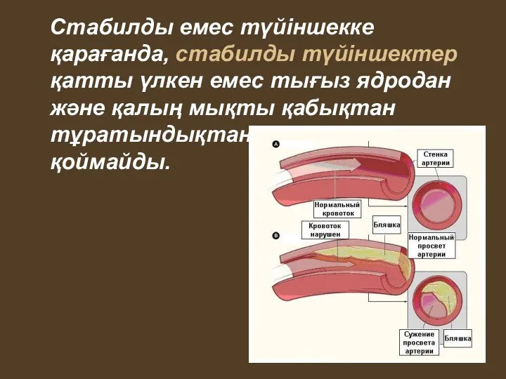 Стабилды емес түйіншекке қарағанда, стабилды түйіншектер қатты үлкен емес тығыз ядродан және қалың