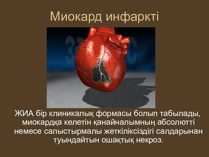 Миокард инфаркті ЖИА бір клиникалық формасы болып табылады,миокардқа келетін қанайналымның абсолютті немесе салыстырмалы