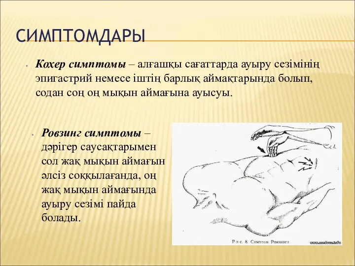 СИМПТОМДАРЫ Кохер симптомы – алғашқы сағаттарда ауыру сезімінің эпигастрий немесе