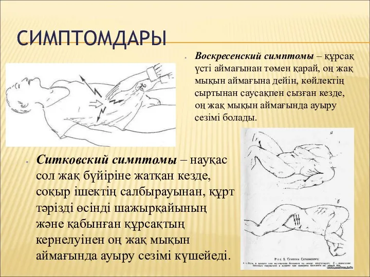 СИМПТОМДАРЫ Ситковский симптомы – науқас сол жақ бүйіріне жатқан кезде,