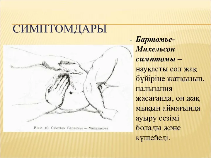 СИМПТОМДАРЫ Бартомье-Михельсон симптомы – науқасты сол жақ бүйіріне жатқызып, пальпация
