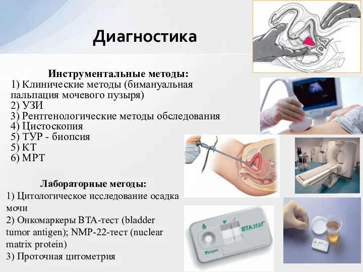 Инструментальные методы: 1) Клинические методы (бимануальная пальпация мочевого пузыря) 2)