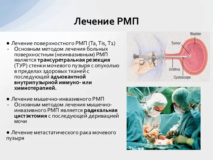 ● Лечение поверхностного РМП (Та, Тis, Т1) Основным методом лечения