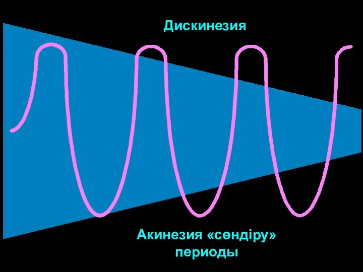 Дискинезия Акинезия «сөндіру» периоды