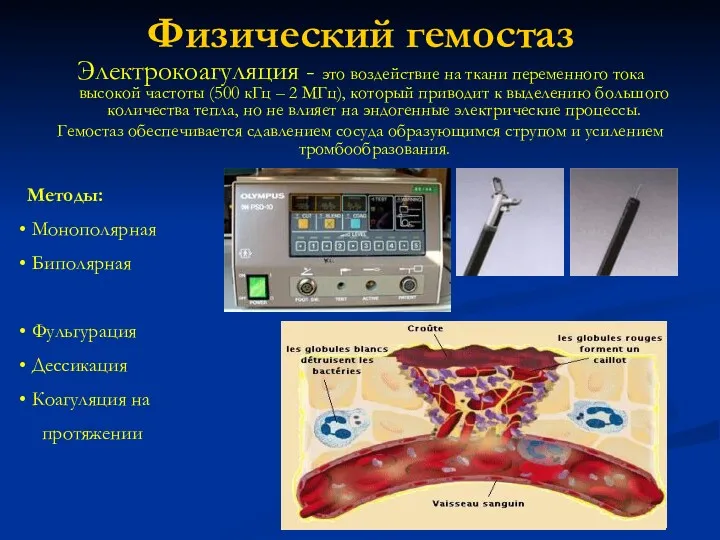 Физический гемостаз Электрокоагуляция - это воздействие на ткани переменного тока высокой частоты (500