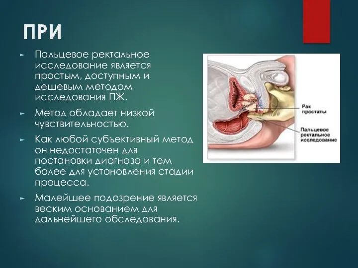 ПРИ Пальцевое ректальное исследование является простым, доступным и дешевым методом