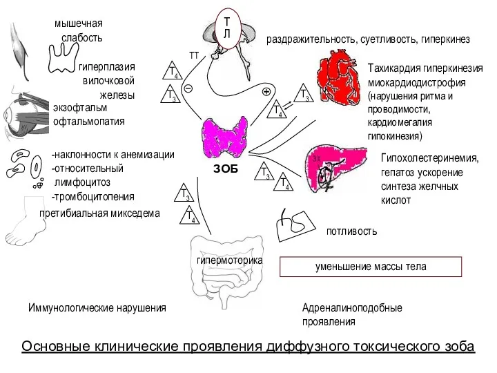 ТЛ ТТ раздражительность, суетливость, гиперкинез Тахикардия гиперкинезия миокардиодистрофия (нарушения ритма