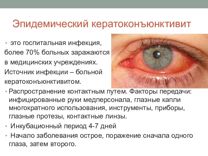 Эпидемический кератоконъюнктивит это госпитальная инфекция, более 70% больных заражаются в медицинских учреждениях. Источник