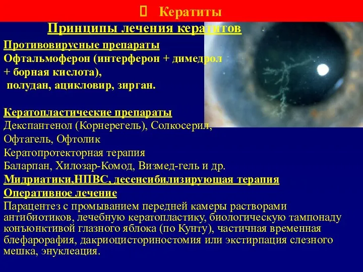 Противовирусные препараты Офтальмоферон (интерферон + димедрол + борная кислота), полудан,