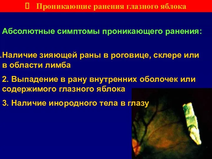 Проникающие ранения глазного яблока Абсолютные симптомы проникающего ранения: Наличие зияющей