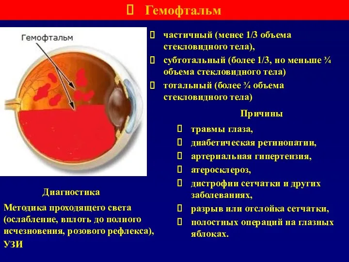 Гемофтальм частичный (менее 1/3 объема стекловидного тела), субтотальный (более 1/3,