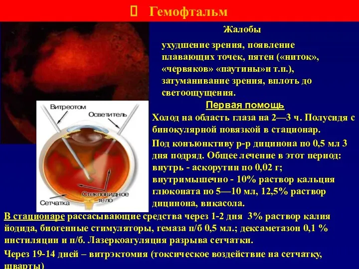 Первая помощь Гемофтальм В стационаре рассасывающие средства через 1-2 дня