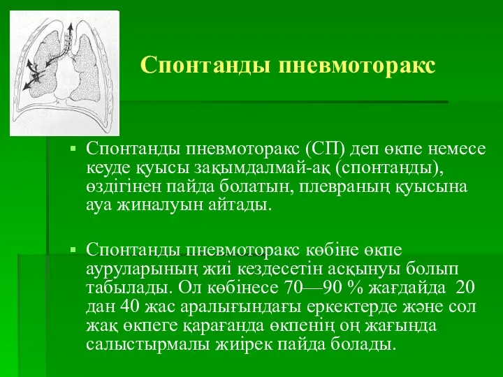 Спонтанды пневмоторакс Спонтанды пневмоторакс (СП) деп өкпе немесе кеуде қуысы зақымдалмай-ақ (спонтанды), өздігінен