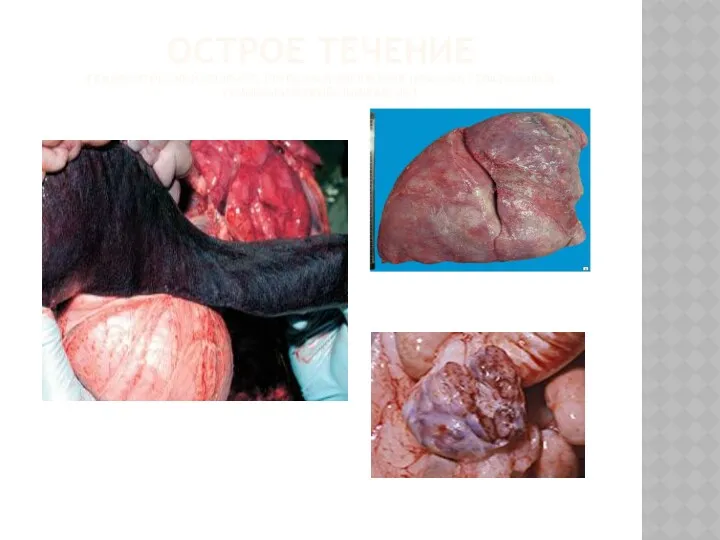 ОСТРОЕ ТЕЧЕНИЕ (ГЕМОРРАГИЧЕСКИЙ СПЛЕНИТ, КРУПОЗНАЯ ПНЕВМОНИЯ (КРАСНАЯ ГЕПАТИЗАЦИЯ), ГЕМОРРАГИЧЕСКИЙ ЛИМФАДЕНИТ