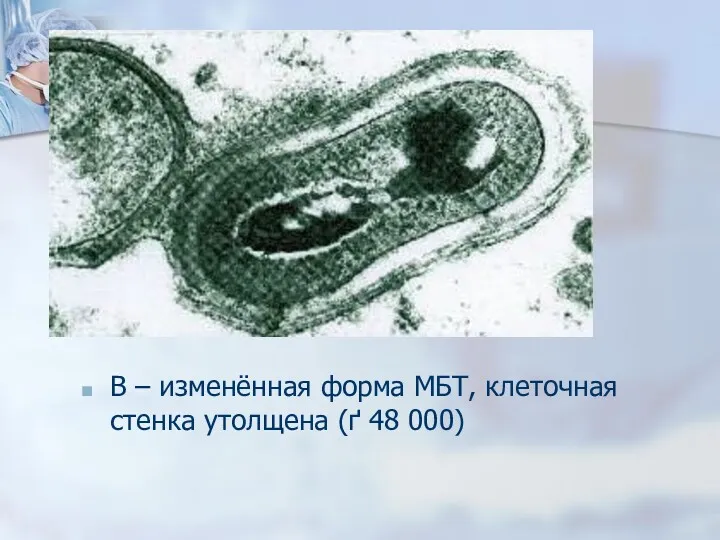 В – изменённая форма МБТ, клеточная стенка утолщена (ґ 48 000)