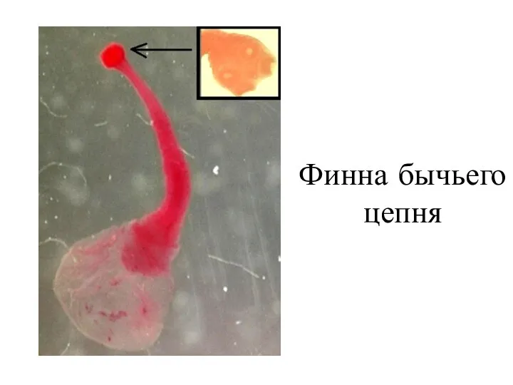 Финна бычьего цепня