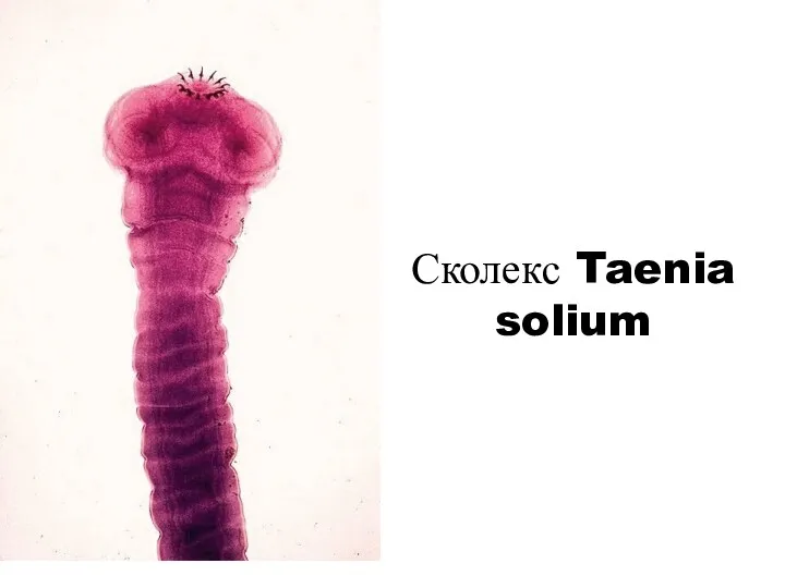 Сколекс Taenia solium