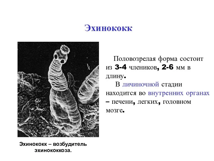 Эхинококк Эхинококк – возбудитель эхинококкоза. Половозрелая форма состоит из 3-4 члеников, 2-6 мм
