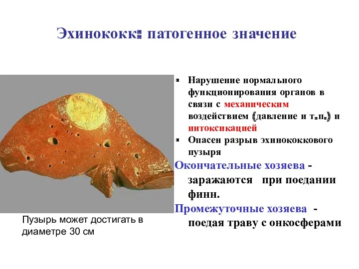 Эхинококк: патогенное значение Пузырь может достигать в диаметре 30 см