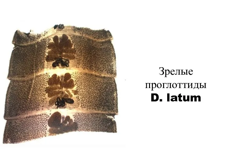 Зрелые проглоттиды D. latum
