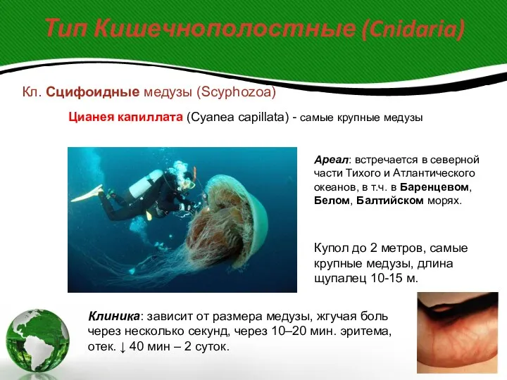 Тип Кишечнополостные (Cnidaria) Кл. Сцифоидные медузы (Scyphozoa) Цианея капиллата (Cyanea