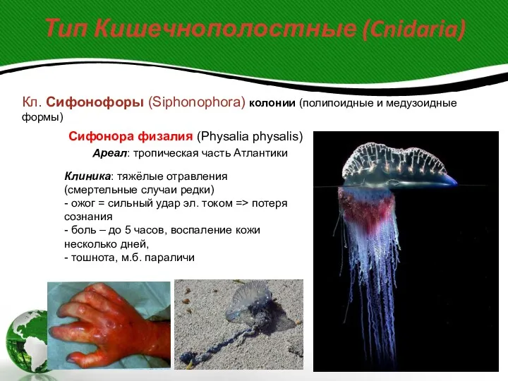 Тип Кишечнополостные (Cnidaria) Кл. Сифонофоры (Siphonophora) колонии (полипоидные и медузоидные