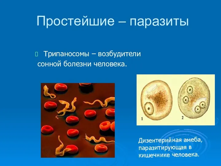 Простейшие – паразиты Трипаносомы – возбудители сонной болезни человека. Дизентерийная амеба, паразитирующая в кишечнике человека.