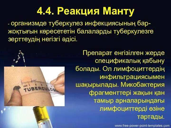 4.4. Реакция Манту - организмде туберкулез инфекциясының бар-жоқтығын көресететін балаларды