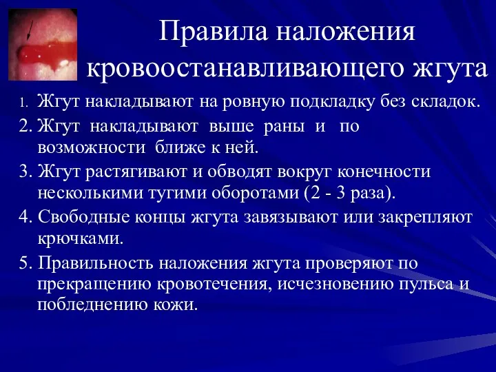 Правила наложения кровоостанавливающего жгута 1. Жгут накладывают на ровную подкладку