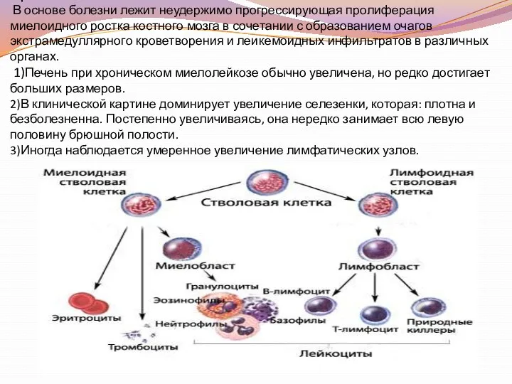 Хронический миелолейкоз. В основе болезни лежит неудержимо прогрессирующая пролиферация миелоидного