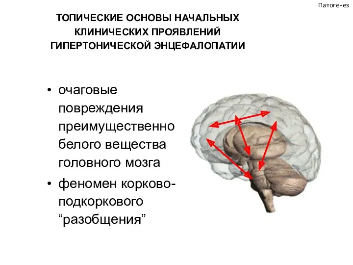 ТОПИЧЕСКИЕ ОСНОВЫ НАЧАЛЬНЫХ КЛИНИЧЕСКИХ ПРОЯВЛЕНИЙ ГИПЕРТОНИЧЕСКОЙ ЭНЦЕФАЛОПАТИИ очаговые повреждения преимущественно