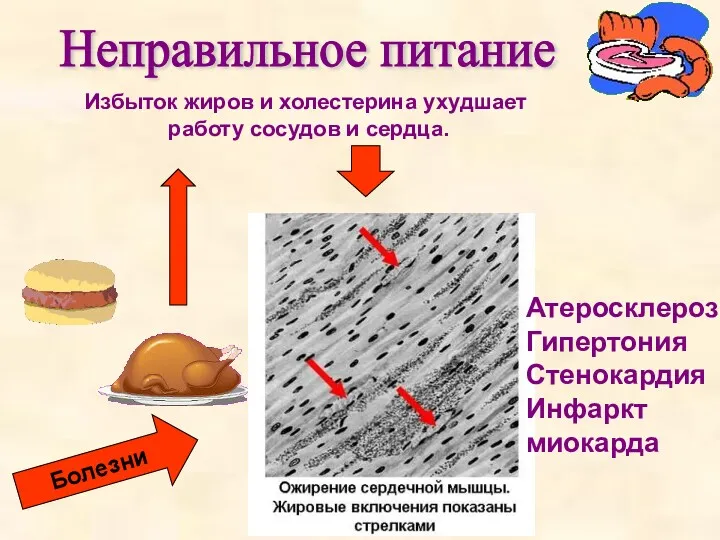 Неправильное питание Избыток жиров и холестерина ухудшает работу сосудов и