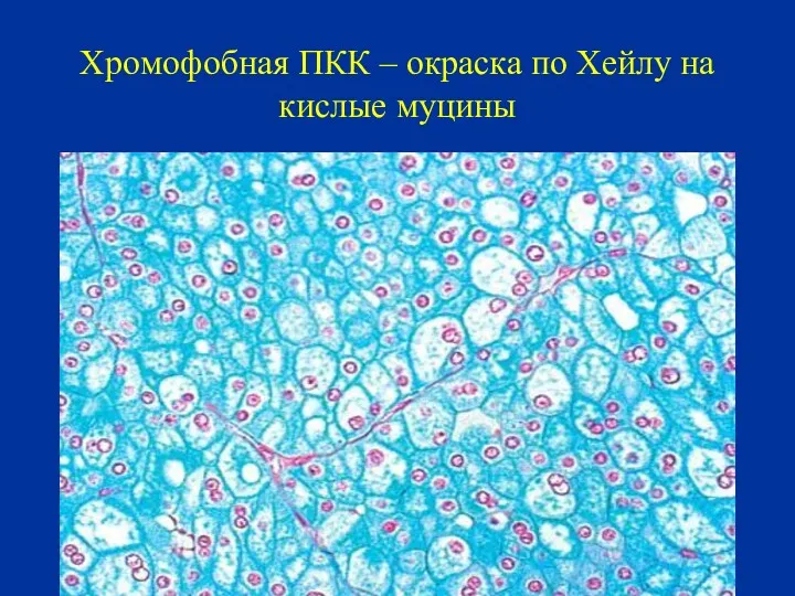 Хромофобная ПКК – окраска по Хейлу на кислые муцины