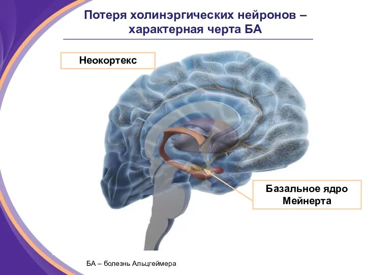 Потеря холинэргических нейронов – характерная черта БА Базальное ядро Мейнерта Неокортекс БА – болезнь Альцгеймера