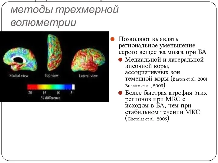 Специфические признаки БА: методы трехмерной волюметрии Позволяют выявлять региональное уменьшение серого вещества мозга