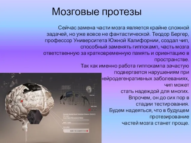 Мозговые протезы Сейчас замена части мозга является крайне сложной задачей,