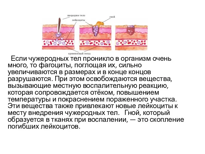 Если чужеродных тел проникло в организм очень много, то фагоциты,