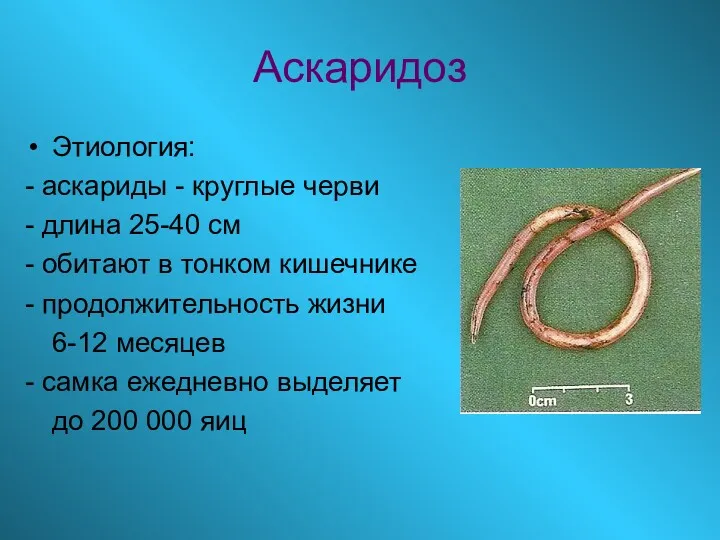 Аскаридоз Этиология: - аскариды - круглые черви - длина 25-40