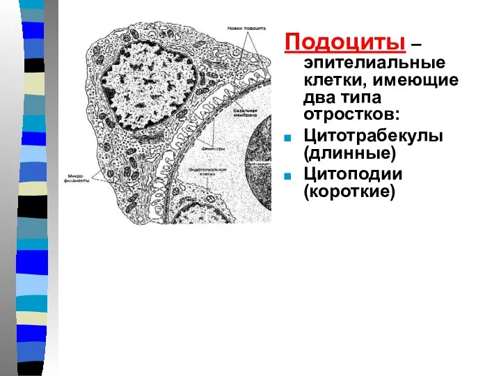 Подоциты – эпителиальные клетки, имеющие два типа отростков: Цитотрабекулы (длинные) Цитоподии (короткие)