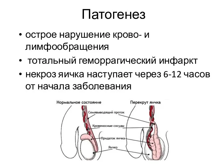 Патогенез острое нарушение крово- и лимфообращения тотальный геморрагический инфаркт некроз