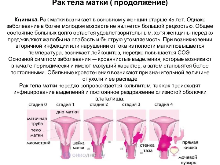 Рак тела матки ( продолжение) Клиника. Рак матки возникает в