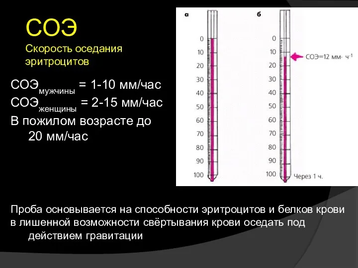 СОЭ Скорость оседания эритроцитов СОЭмужчины = 1-10 мм/час СОЭженщины =