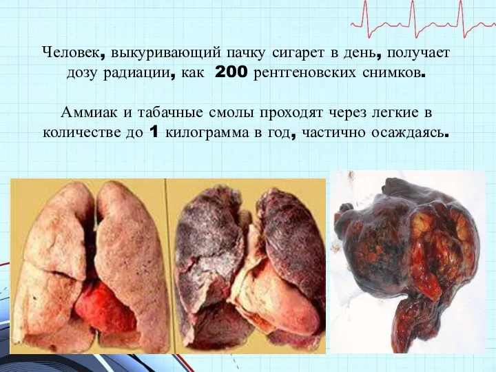 Человек, выкуривающий пачку сигарет в день, получает дозу радиации, как 200 рентгеновских снимков.
